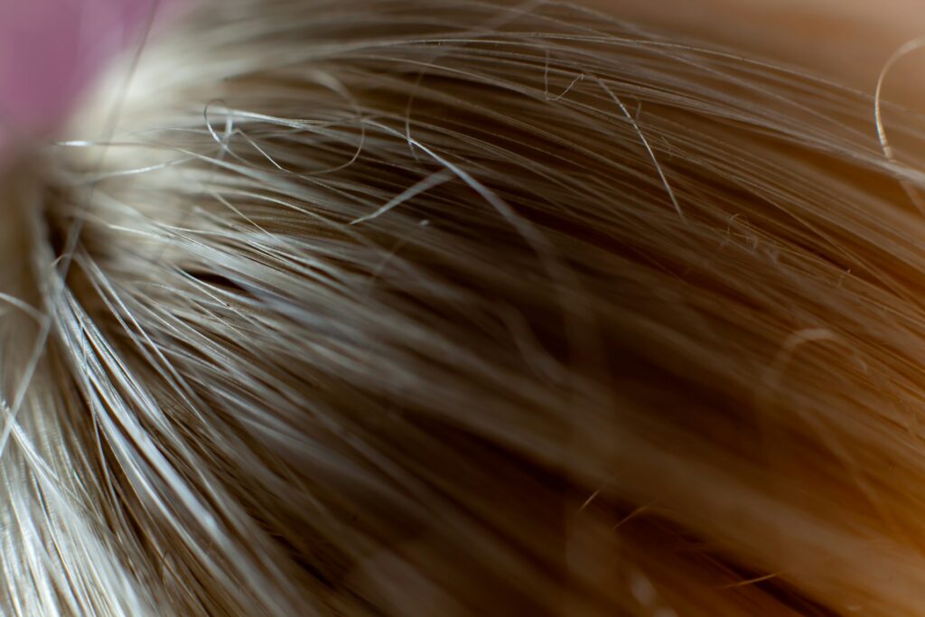 Close-up of healthy hair strands representing the post-transplant recovery progression at Validus Hair