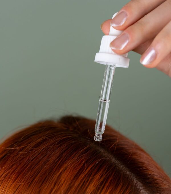 Applying hair serum to the scalp as part of post-transplant mesotherapy aftercare