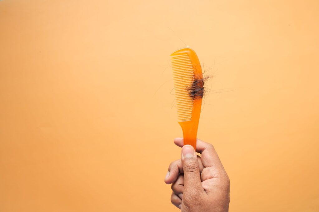 Hair strands on a comb illustrating temporary shock loss after a hair transplant